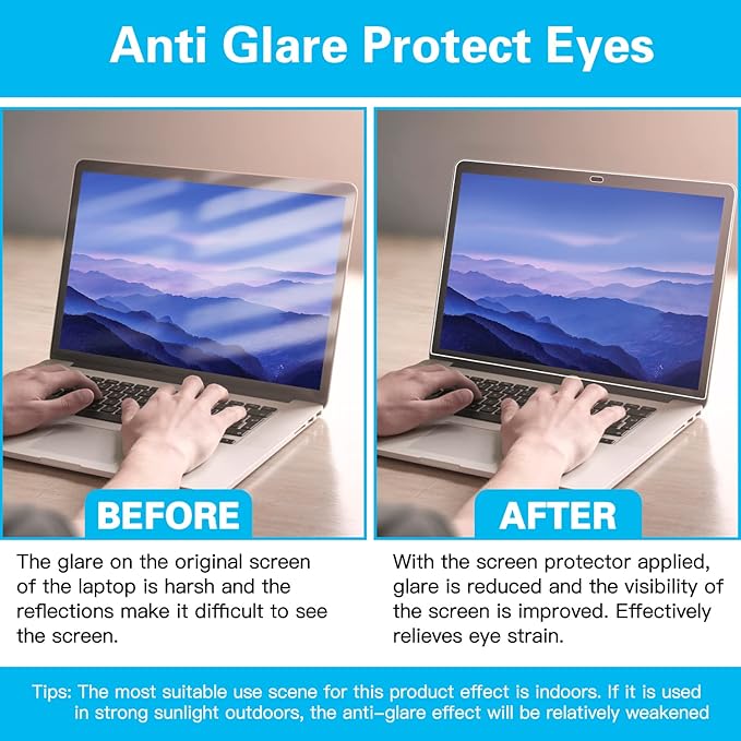 حزمة كينديكس KX3281 ٤ في ١ – لاصق حماية شاشة، غطاء لوحة مفاتيح، ملصق لابتوب شفاف، ودراغ مسند يد – مقاس 15.6 بوصة