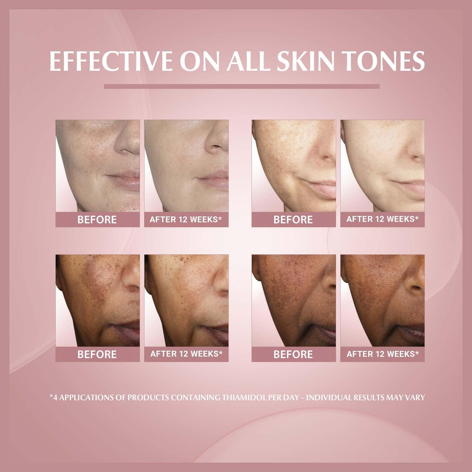 يوسيرين مصل الوجه ايفن بيجمنت بيرفيكتور سكين بيرفيكتينج مع الثياميدول وحمض الهيالورونيك، يقلل من بقع الصبغة، لمعان مرئي على البشرة، مرطب لجميع أنواع البشرة، 30 مل