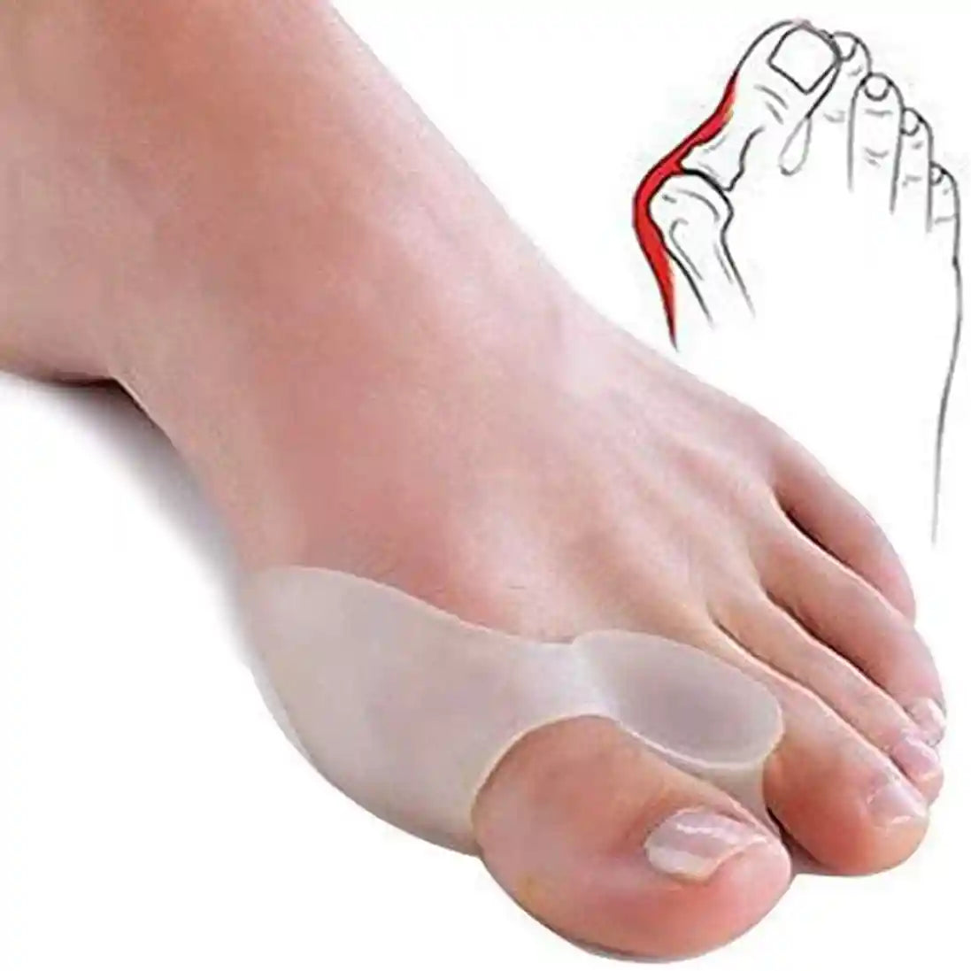 فواصل أصابع سيليكون من زنوورلد – 2 قطعة لتخفيف آلام القدم وتصحيح انحراف الإبهام – Safqqa Egypt