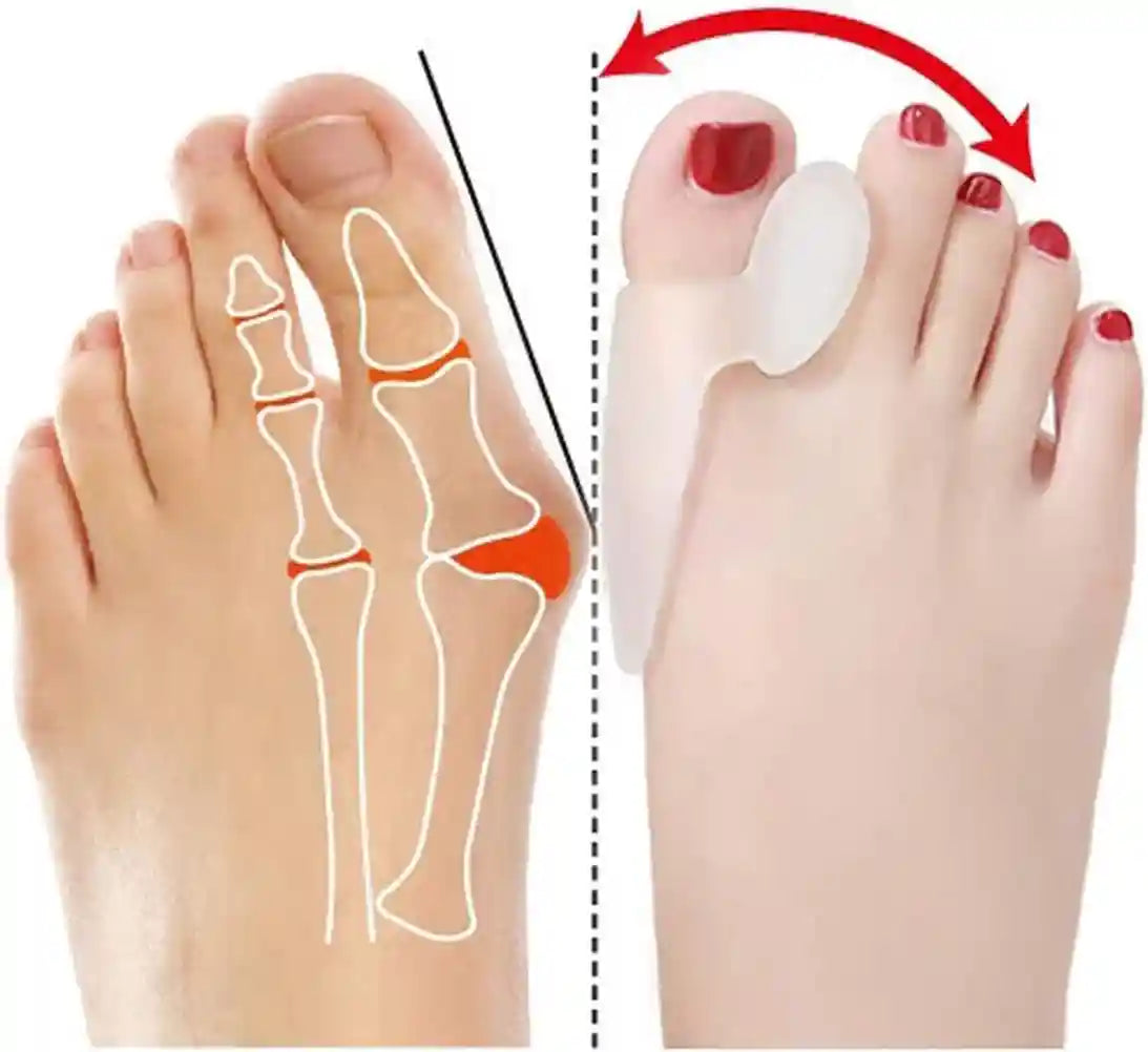 فواصل أصابع سيليكون من زنوورلد – 2 قطعة لتخفيف آلام القدم وتصحيح انحراف الإبهام – Safqqa Egypt