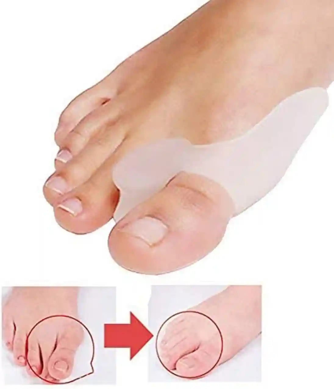 فواصل أصابع سيليكون من زنوورلد – 2 قطعة لتخفيف آلام القدم وتصحيح انحراف الإبهام – Safqqa Egypt