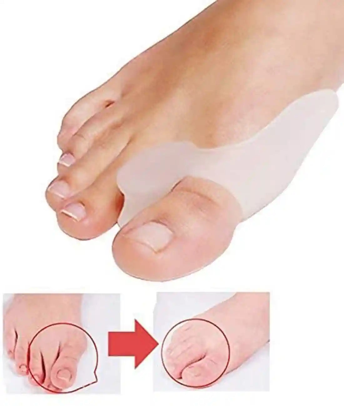 فواصل أصابع سيليكون من زنوورلد – 2 قطعة لتخفيف آلام القدم وتصحيح انحراف الإبهام – Safqqa Egypt