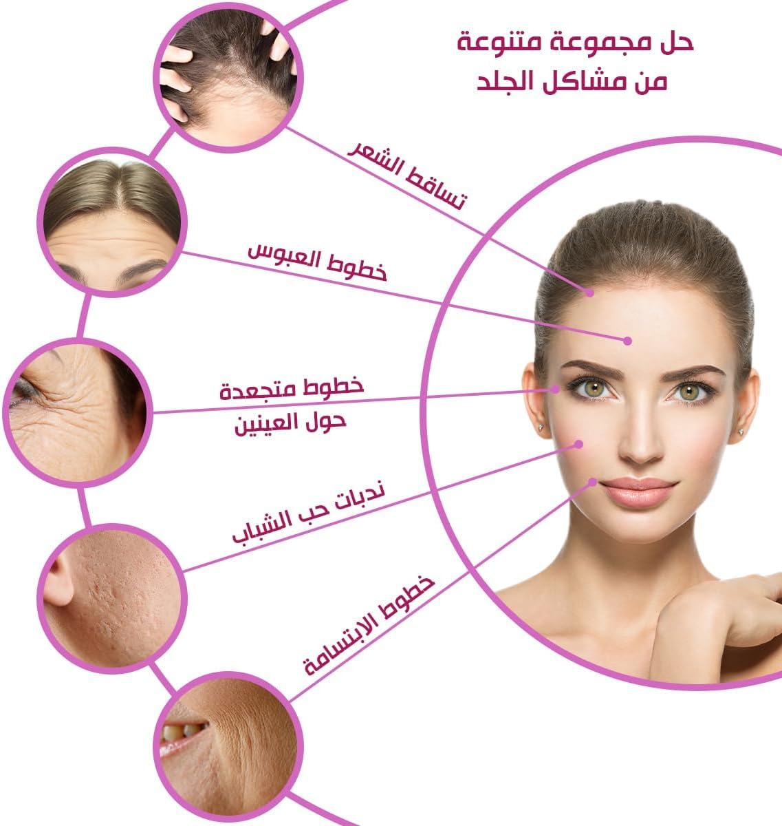 QSHOP® درما رولر لفروة الرأس، 540 إبر تيتانيوم دقيقة لفروة الرأس للوجه، الرقبة، الجسم، نمو الشعر، 0.5 مم للتجاعيد، حب الشباب، علامات التمدد