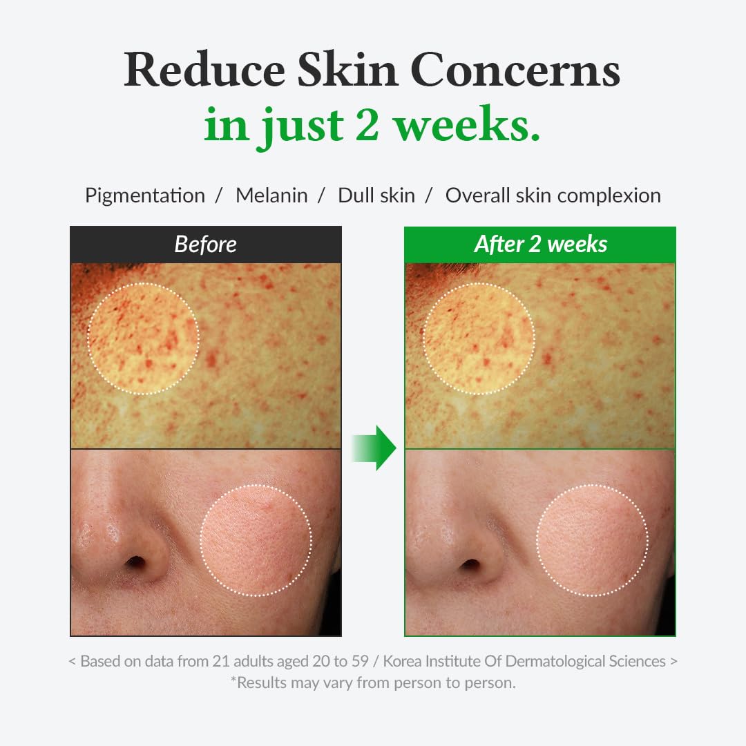 سيروم فيتامين سي اللطيف من د. ألتيا – أحد منتجات العناية الكورية المميزة المصمم خصيصًا للبشرة الحساسة. يحتوي هذا السيروم النباتي الخفيف على فيتامين سي الذي يساعد على توحيد لون البشرة وتقليل التصبغات والبقع الداكنة 