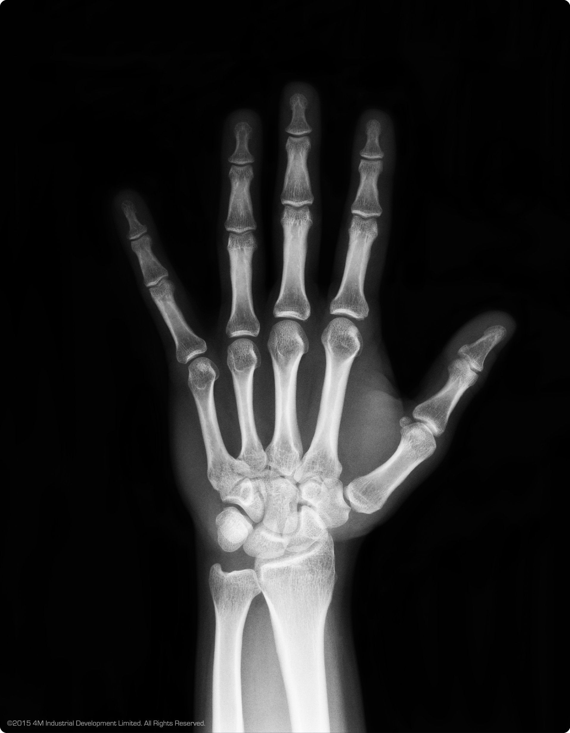 ألعاب الهيكل العظمي البشري