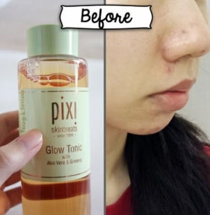 تونك للعناية بالبشرة من بيكسي بحجم 250 مل، مصمم لتنظيف البشرة وتنعيمها ومنحها الحيوية. يحتوي على مكونات لطيفة ومرطبة تساعد في إزالة الشوائب، شد المسام، والحفاظ على توازن البشرة الطبيعي