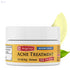 De La Cruz Acne Treatment with 10% Sulfur - Mini Size (6g) - Safqqa