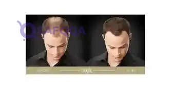 Hair Building Fibers Dark Brown 27.5grams - Safqqa Egypt